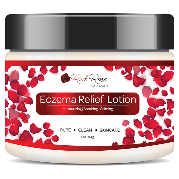 Eczema Relief Lotion